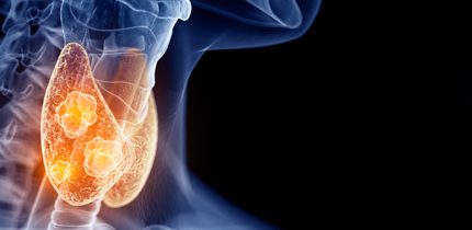 Relação entre poluentes ambientais e cancro da tiroide